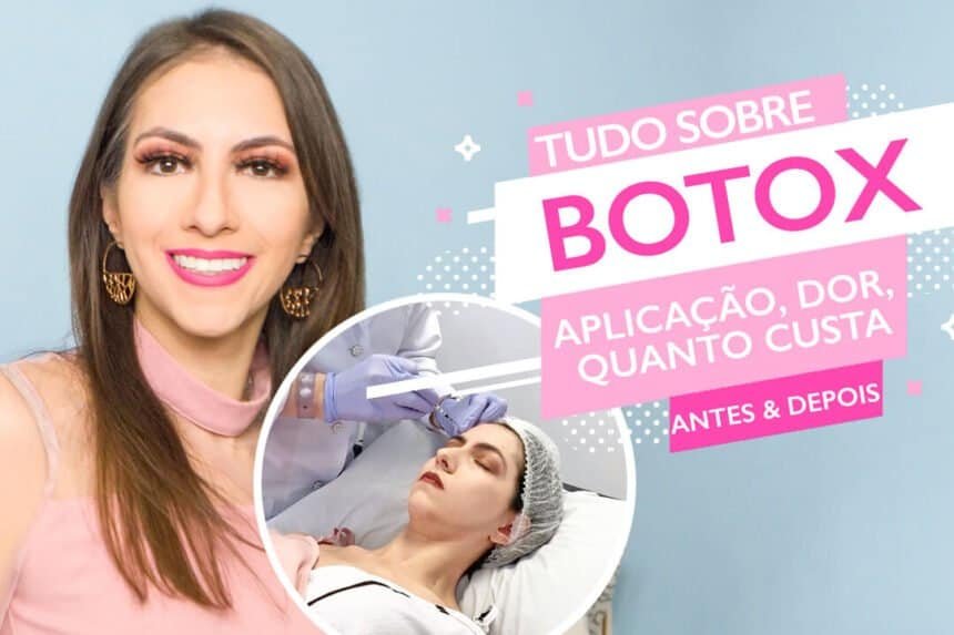 Botox no rosto: Antes e depois