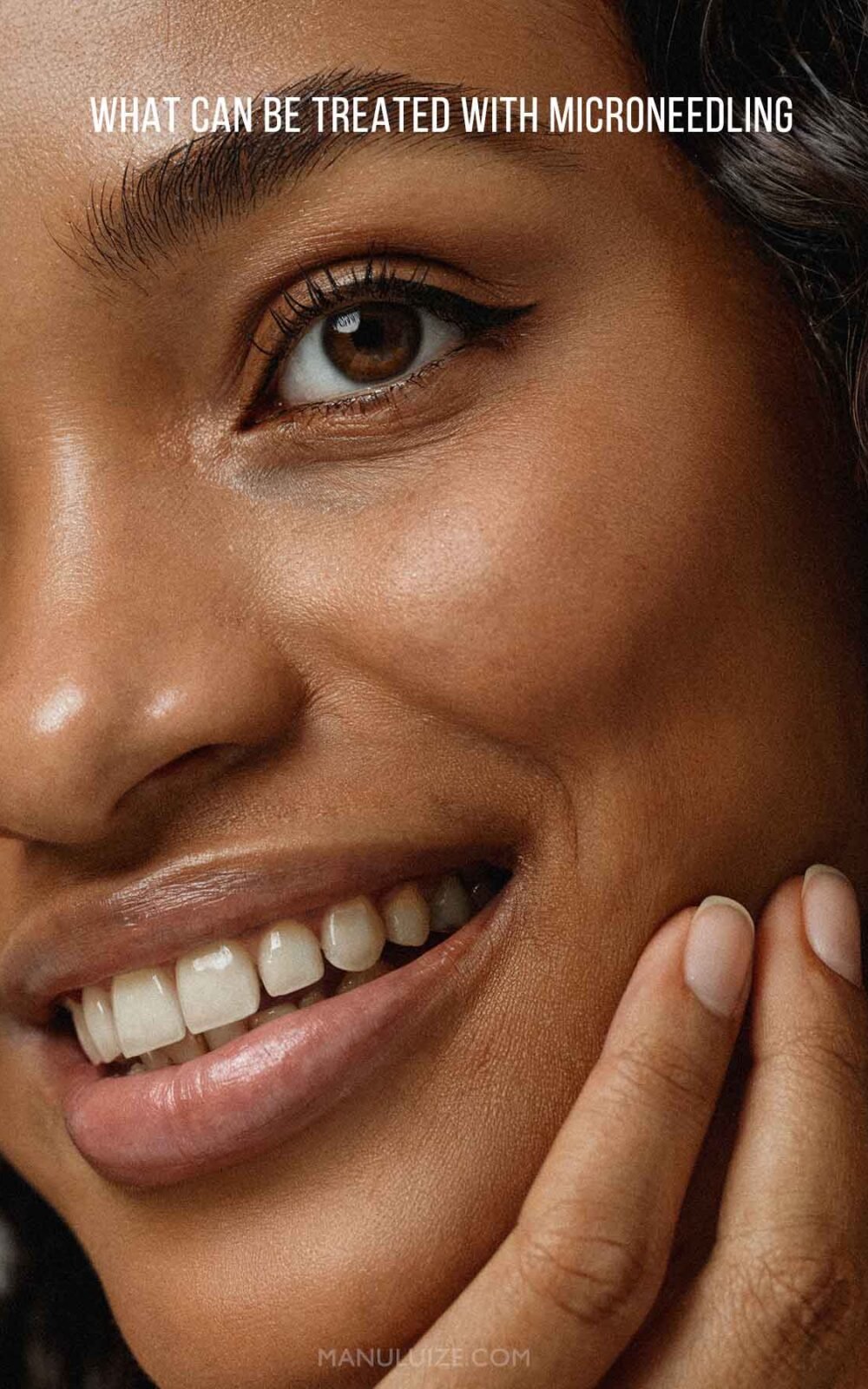 What Can Be Treated With Microneedling